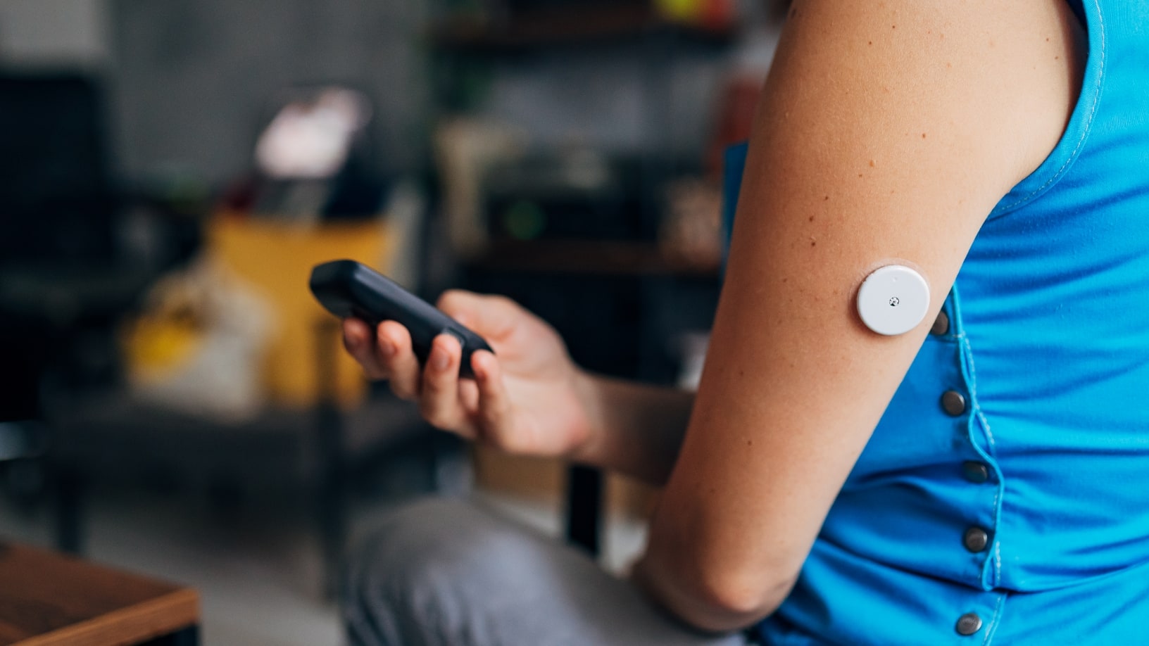 glucose monitor arm remote A close-up of a person's upper arm with a continuous glucose monitor sensor, while they hold a remote control or small device in their hand